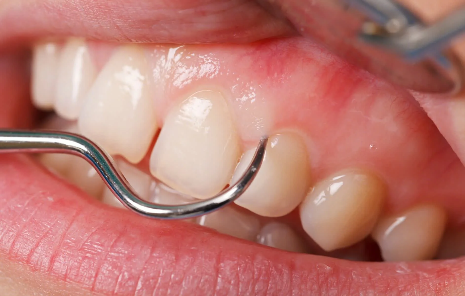 Ảnh 40 minh hoạ phụ liệu tóc