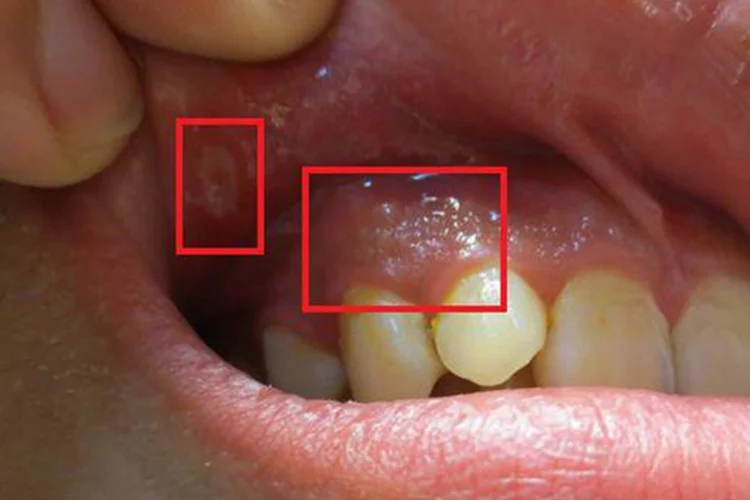phụ liệu tóc — ảnh 61