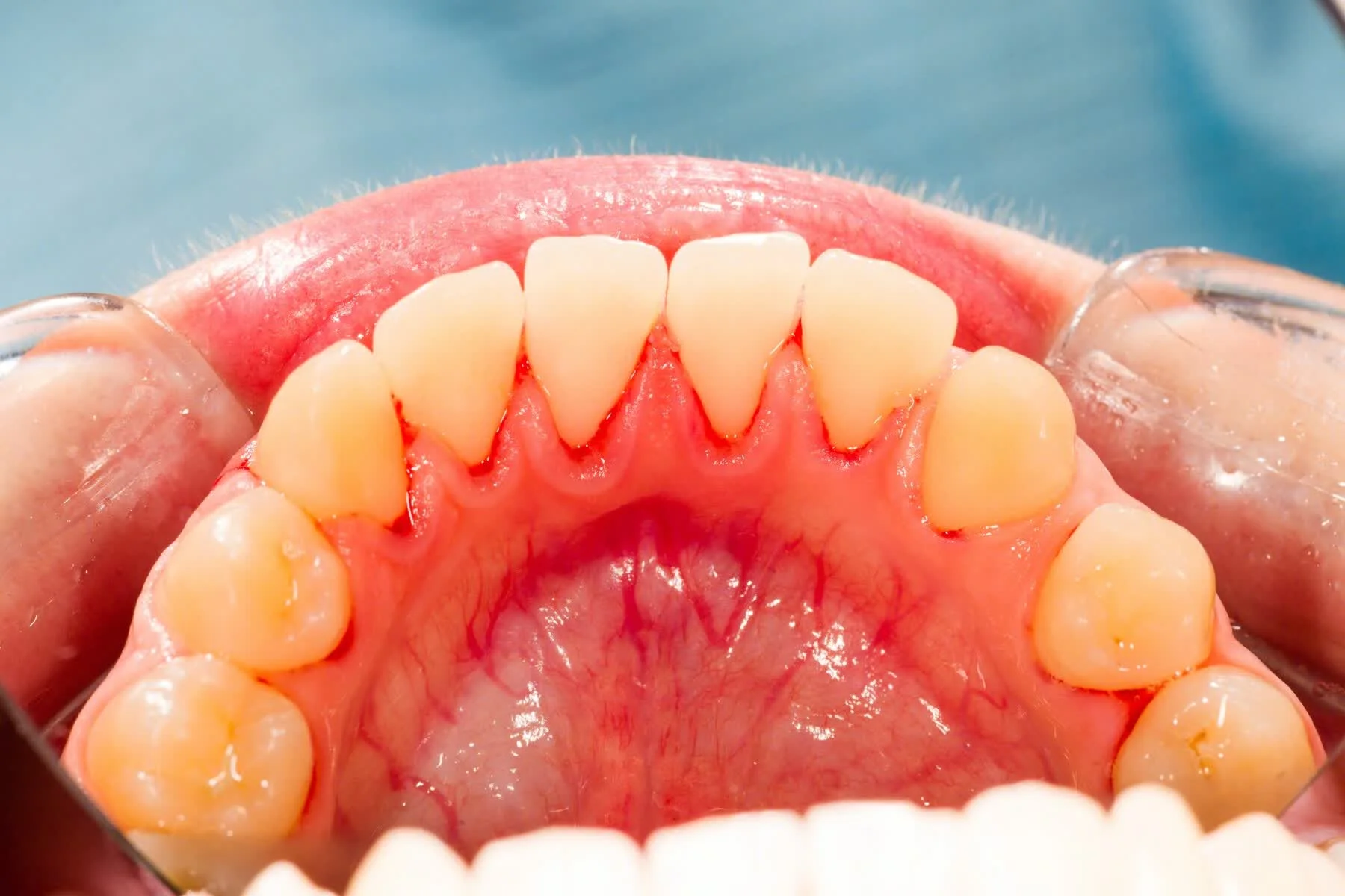 phụ liệu tóc - mẫu 43